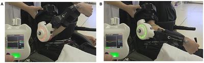 Voluntary Elbow Extension-Flexion Using Single Joint Hybrid Assistive Limb (HAL) for Patients of Spastic Cerebral Palsy: Two Cases Report